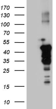 Monoclonal Mouse anti-Human GRB4 / NCK2 Antibody (clone OTI4H7, WB)
