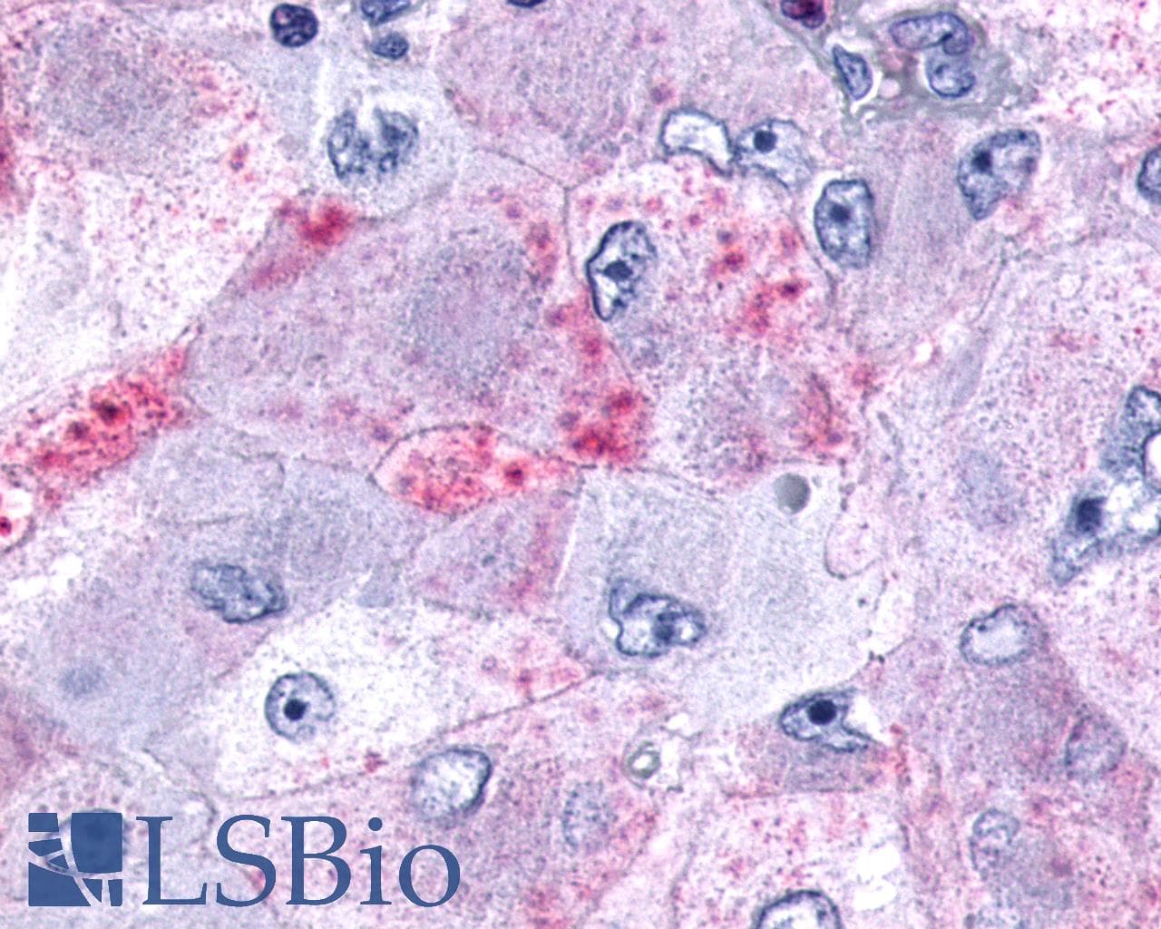 IHC-plus™ Polyclonal Rabbit anti-Human MCHR1 Antibody (N-Terminus, IHC)