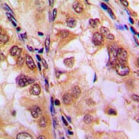 HDAC8 Antibody (phospho-Ser39)