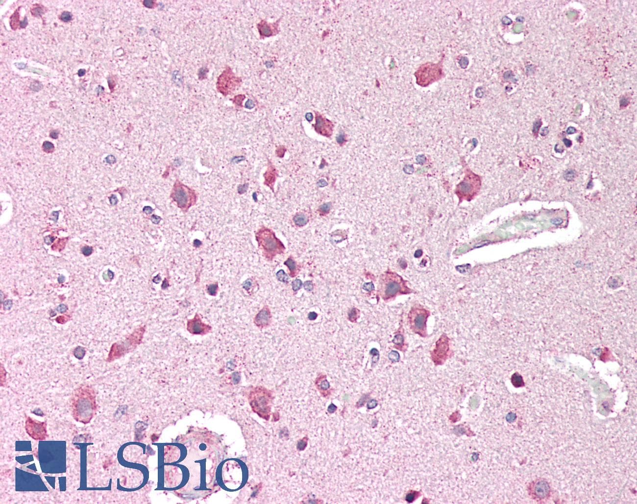 IHC-plus™ HMG-CoA Reductase / HMGCR Antibody