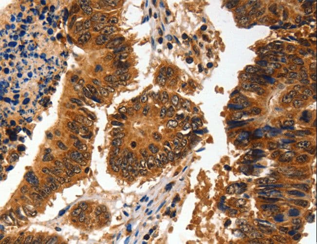 Polyclonal Rabbit anti-Human ADAP1 / CENTA1 Antibody (IHC, WB)