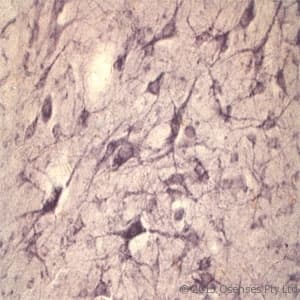 Polyclonal Rabbit anti-Rat SORT1 / Sortilin Antibody (N-Terminus, IHC, WB)
