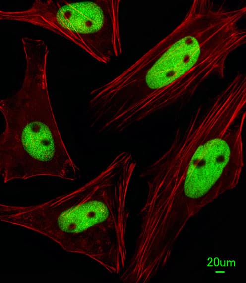 KRBA2 Antibody (aa157-186)