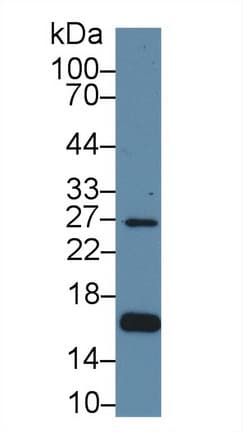 AQP2 / Aquaporin 2 Antibody (aa177-271, Biotin)