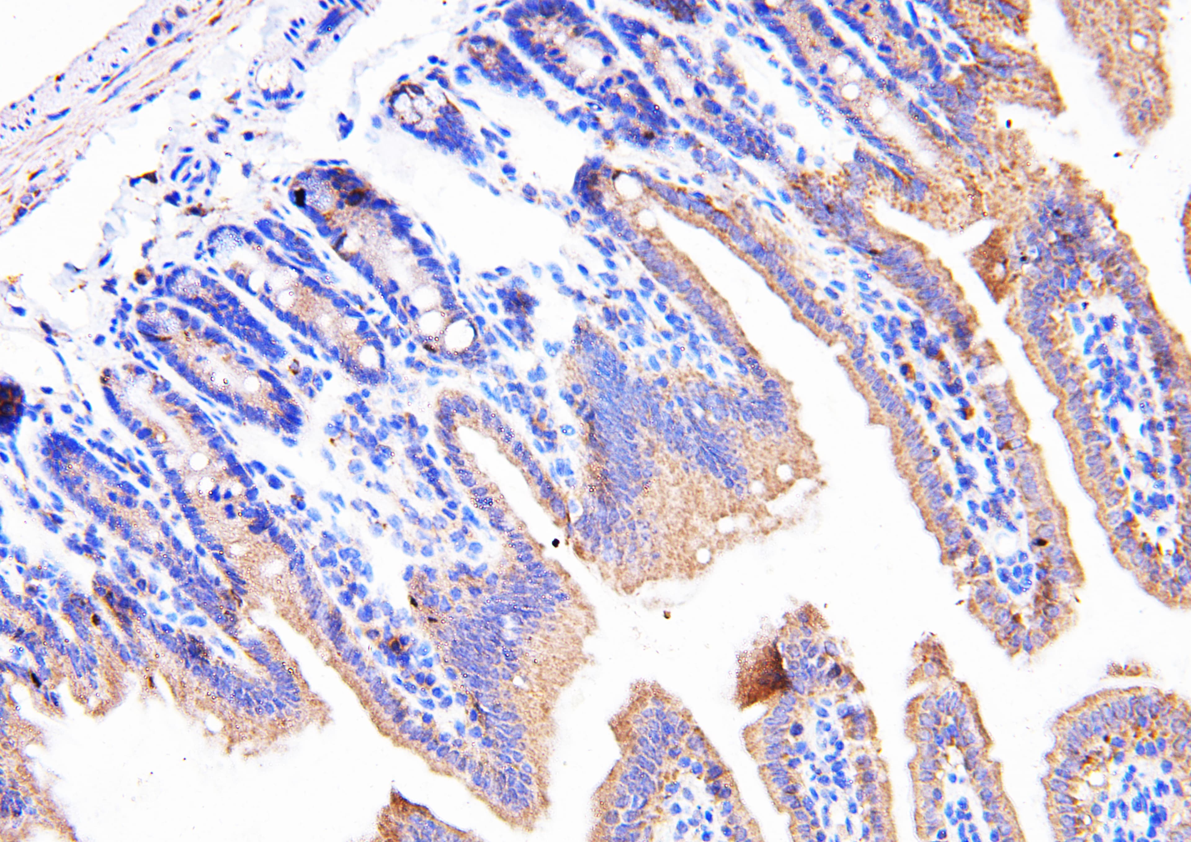 PPIB / Cyclophilin B Antibody (aa176-196)