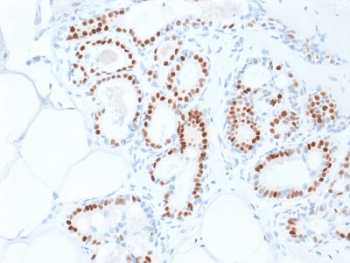 ER Alpha / Estrogen Receptor Antibody (clone ESR1/1935)