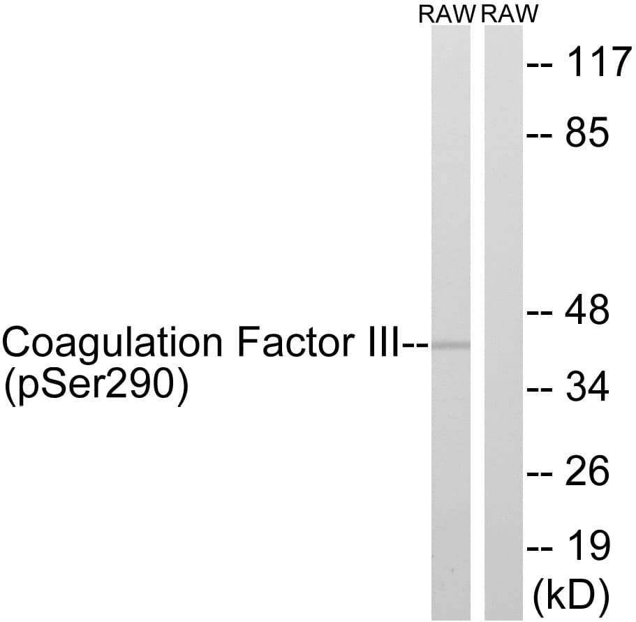 F3 / CD142 / Tissue factor Antibody (phospho-Ser290)