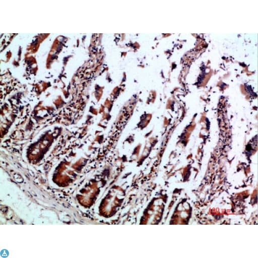IL12B / IL12 p40 Antibody