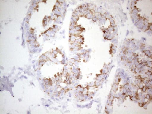 KRT19 / CK19 / Cytokeratin 19 Antibody (aa240-390, clone UMAB187, Carrier-free)