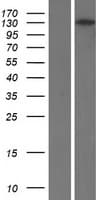 RBP3 / IRBP Protein (Over-Expression Lysate Myc-DDK (Flag))