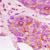 MAP2K3 / MEK3 / MKK3 Antibody (phospho-Thr222)