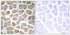 IHC-plus™ SLC16A12 / MCT12 Antibody (aa115-164)