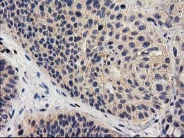 MEF2C Antibody (clone OTI4F7)