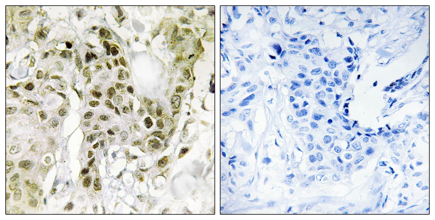 BCOR Antibody (aa1231-1280)