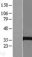 EPHX4 / Epoxide Hydrolase 4 Protein (Over-Expression Lysate Myc-DDK (Flag))