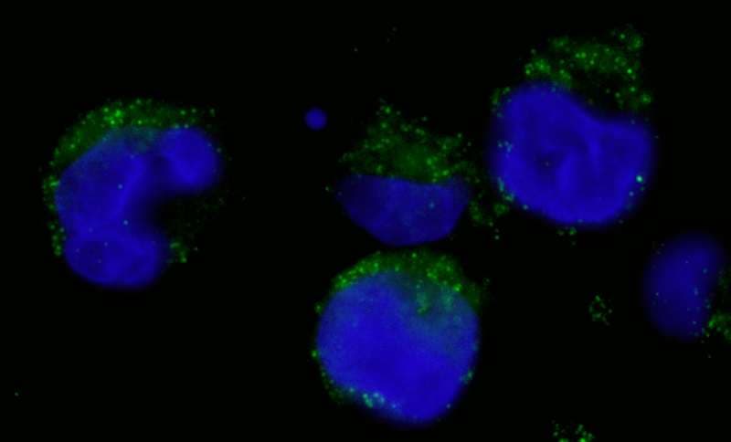 CML / BCR Antibody (aa1221-1271)