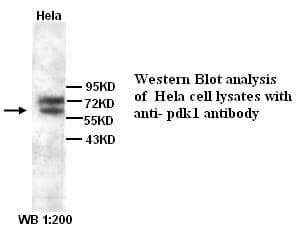 IHC-plus™ PDPK1 / PDK1 Antibody