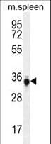 SIP / TP53INP1 Antibody (aa181-210)