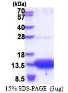 Human SLC51B / OSTBETA Protein (Recombinant His)