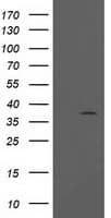 PIH1D2 Antibody (clone OTI5C12)
