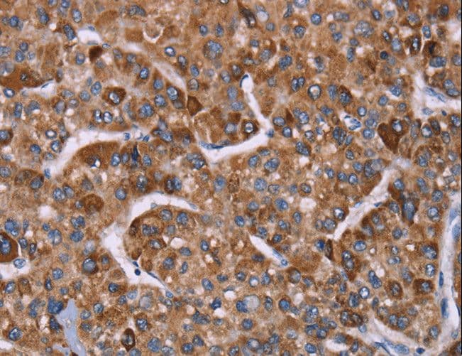 HSP10 / Cpn10 / Chaperonin 10 Antibody