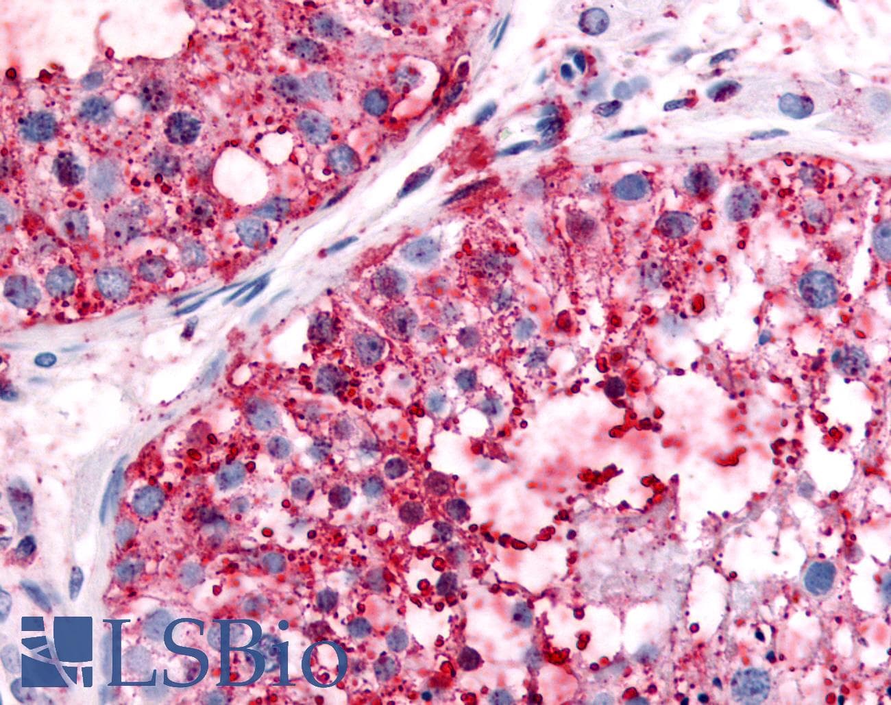 IHC-plus™ Polyclonal Rabbit anti-Human UCHL3 Antibody (Internal, IHC)