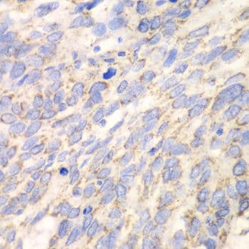 DLD / Diaphorase / E3 Antibody