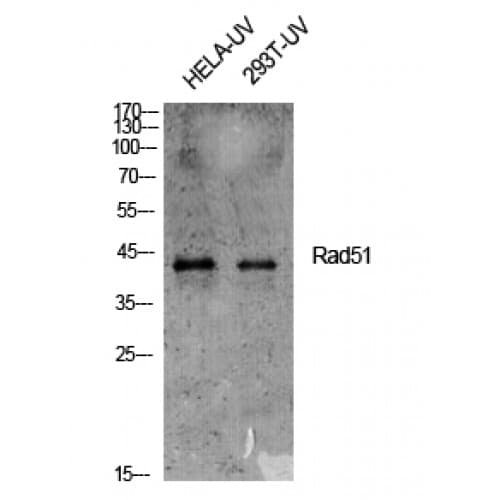 Polyclonal Rabbit anti-Human RAD51 / RECA Antibody (250-330 aa, IHC, WB)