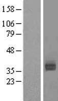 ASGR2 Protein (Over-Expression Lysate Myc-DDK (Flag))