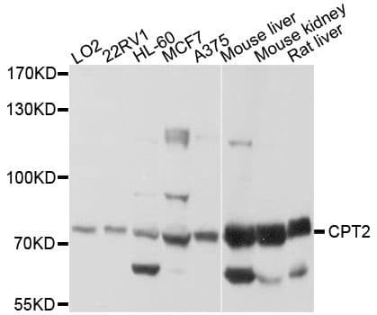 CPT2 Antibody