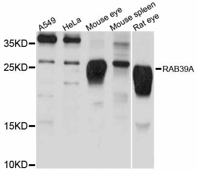 RAB39 / RAB39A Antibody