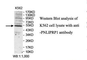 Polyclonal Rabbit anti-Human PNLIPRP1 Antibody (aa207-385, IHC, WB)