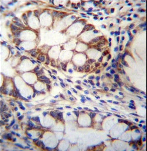 GPSM1 / AGS3 Antibody (aa439-468)