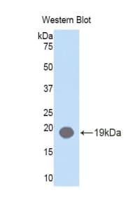 DHH / Desert Hedgehog Antibody (aa241-383)