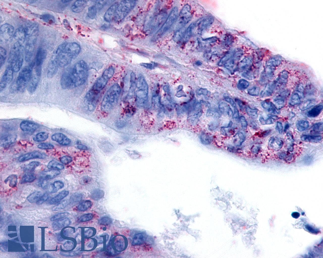 PathPlus™ GPR63 Antibody (C-Terminus)