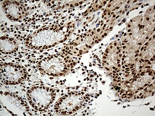 DDX39B / UAP56 Antibody (aa319-428, clone OTI2F11)