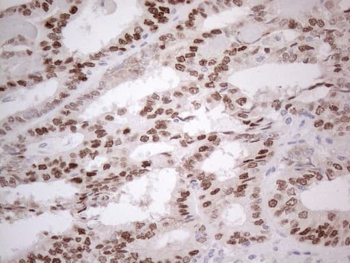 ER Alpha / Estrogen Receptor Antibody (aa1-310, clone OTI5E11)