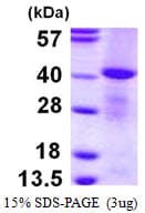 Human Mannose Phosphate Isomerase Protein (Recombinant His)
