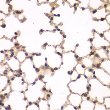 Polyclonal Rabbit anti-Human PIP4K2A / PIPK Antibody (IHC, IF, WB)