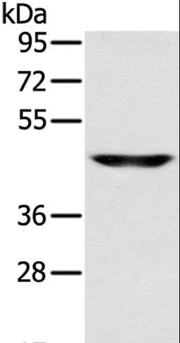 Polyclonal Rabbit anti-Human SLC16A8 Antibody (IHC, WB)