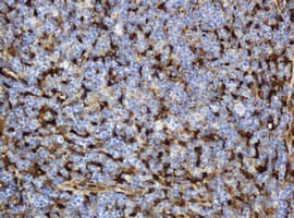 TP / Thymidine Phosphorylase Antibody (clone OTI7B4)