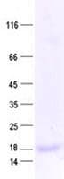 Human RPL36 / Ribosomal Protein L36 (Recombinant His, N-Terminal)