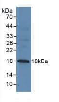 EMA / MUC1 Antibody (aa1098-1255, APC)