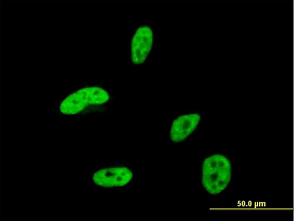 Monoclonal Mouse anti-Human HOXA9 Antibody (clone 2A11-2D2, IHC, IF, WB)