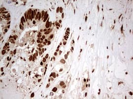 TIPIN Antibody (clone OTI2E6)