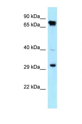 Polyclonal Rabbit anti-Human CDK4 Antibody (C-Terminus, WB)