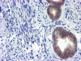 GSTO2 Antibody (clone OTI2A12)