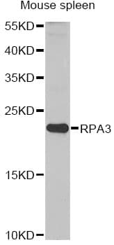 Polyclonal Rabbit anti-Human RPA3 Antibody (IF, WB)