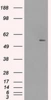 SLC2A5 / GLUT5 Antibody (clone OTI12F2)