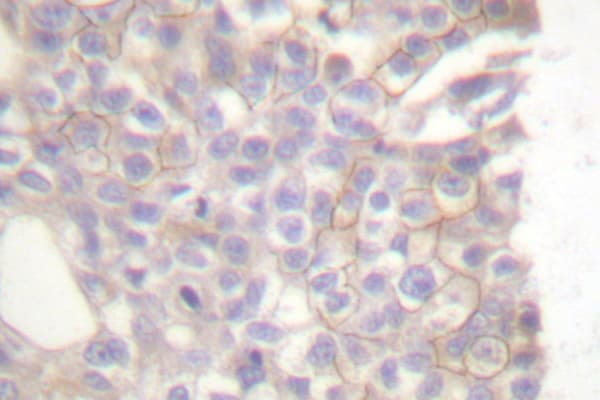 BCL2L11 / BIM Antibody (Ala2)